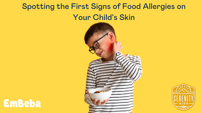 Spotting the First Signs of Food Allergies on Your Child's Skin