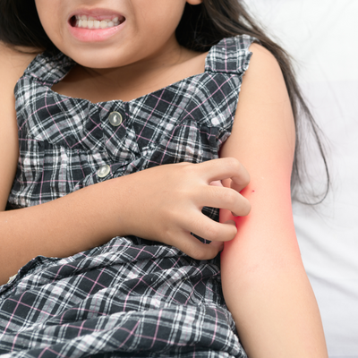 Does Your Child Have Textile Dermatitis?